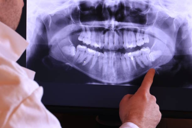 Best Emergency Dental Care for Abscessed Tooth in Kennesaw, GA