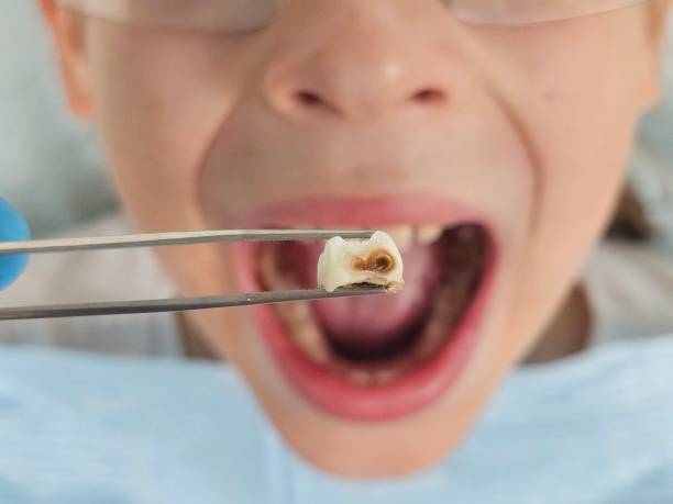 Best Mobile Emergency Dentist in Kennesaw, GA